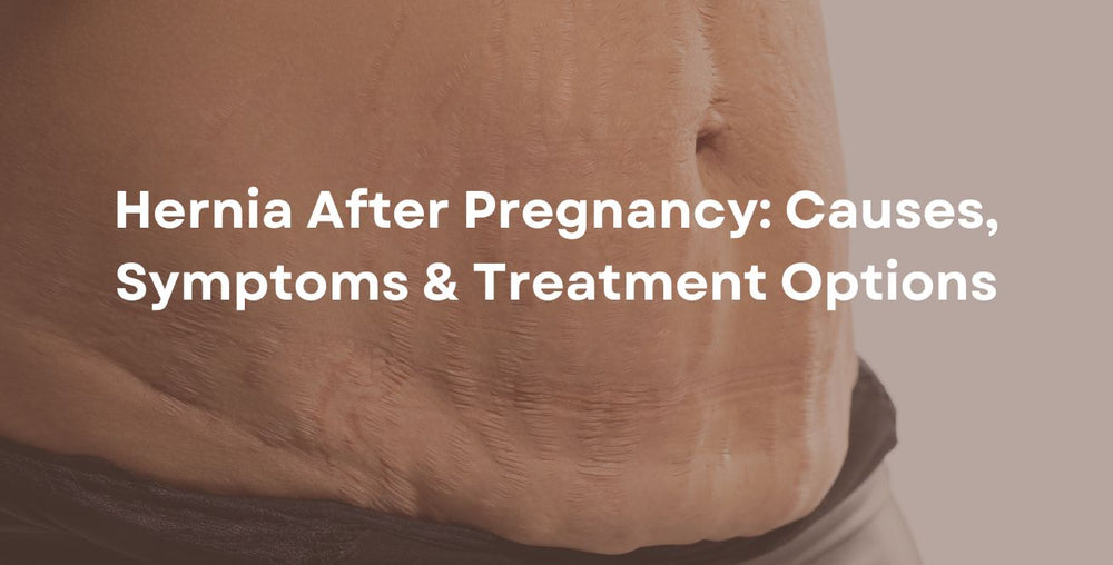 Hernia After Pregnancy Causes, Symptoms & Treatment Options