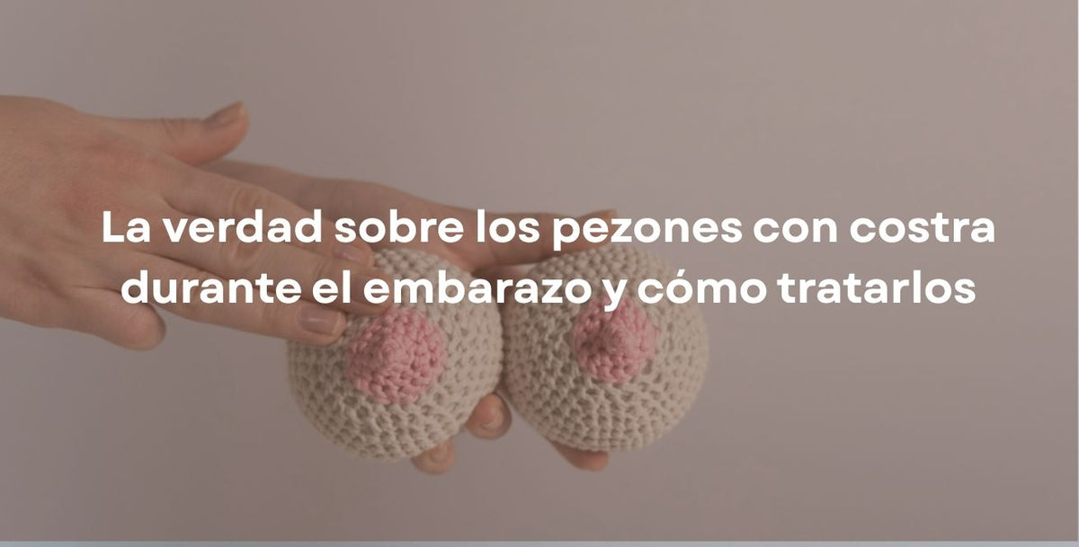 La verdad sobre los pezones con costra durante el embarazo y cómo tratarlos