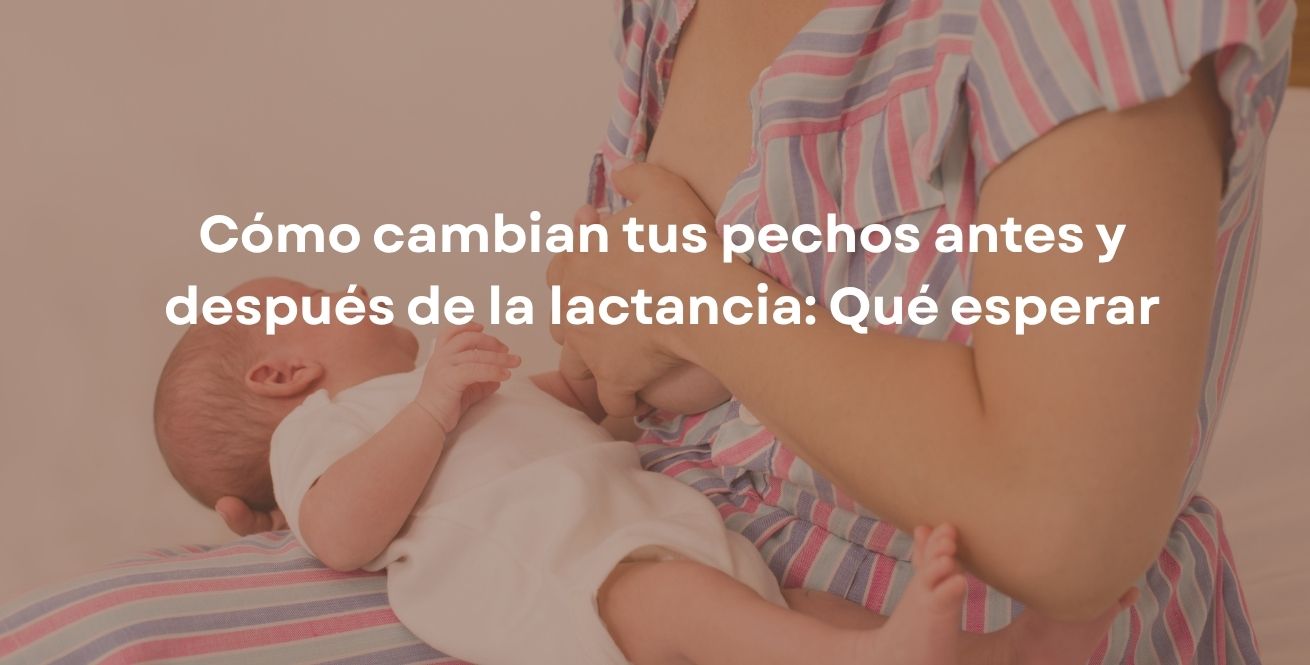 Cómo cambian tus pechos antes y después de la lactancia: Qué esperar