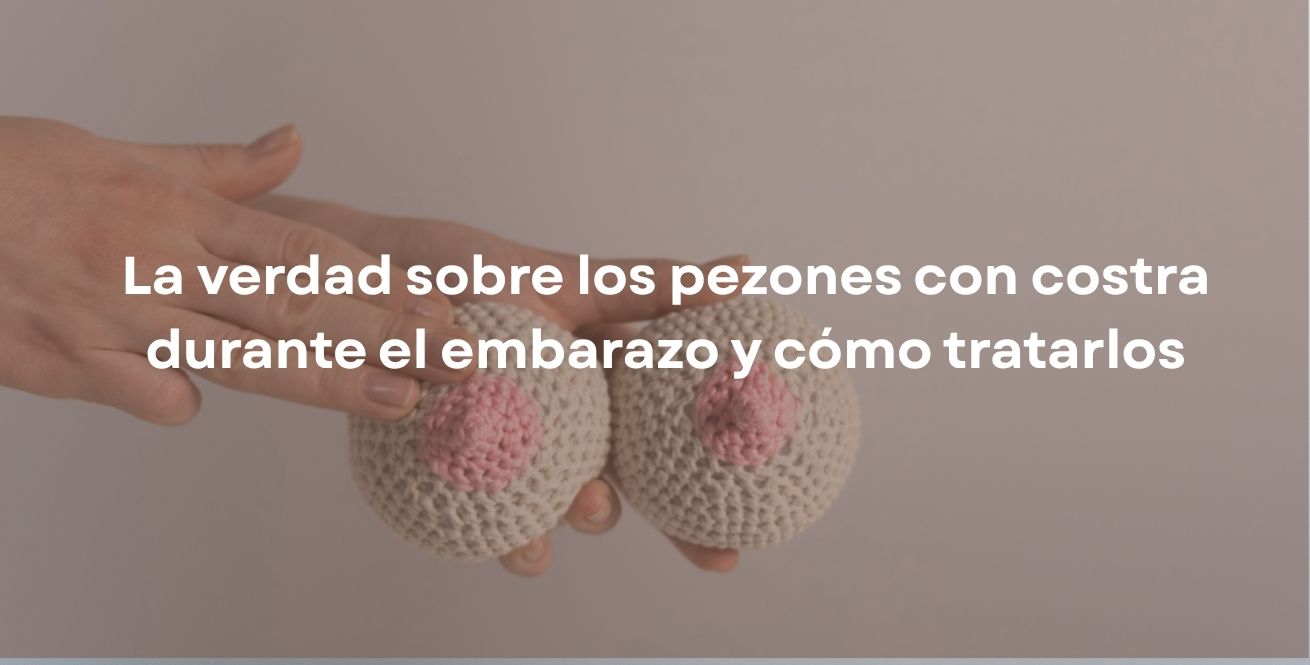 La verdad sobre los pezones con costra durante el embarazo y cómo tratarlos