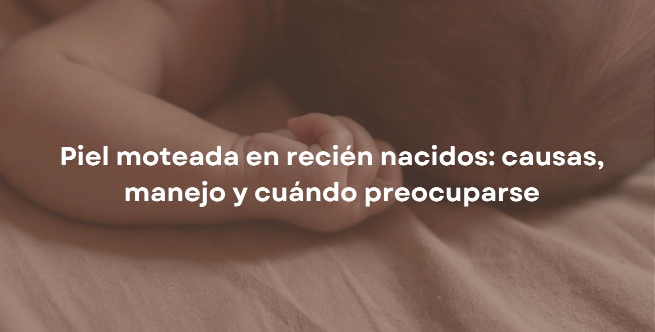 Piel moteada en recién nacidos: causas, manejo y cuándo preocuparse