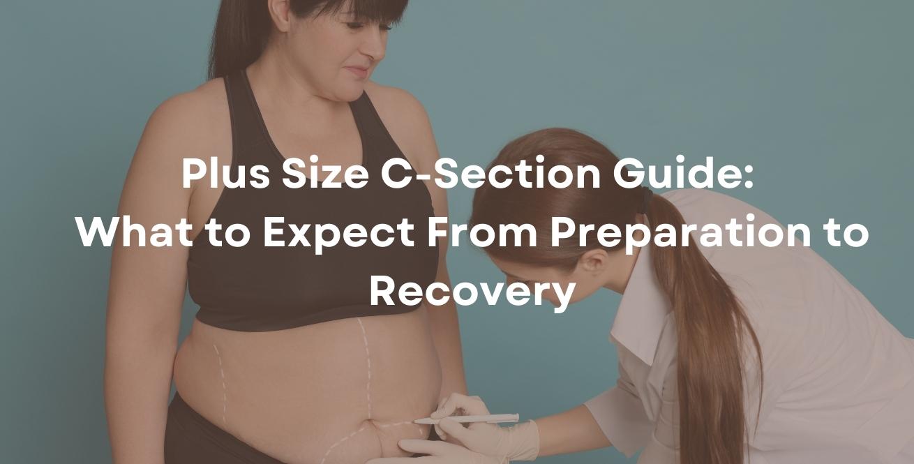 Plus Size C-Section Guide: What to Expect From Preparation to Recovery