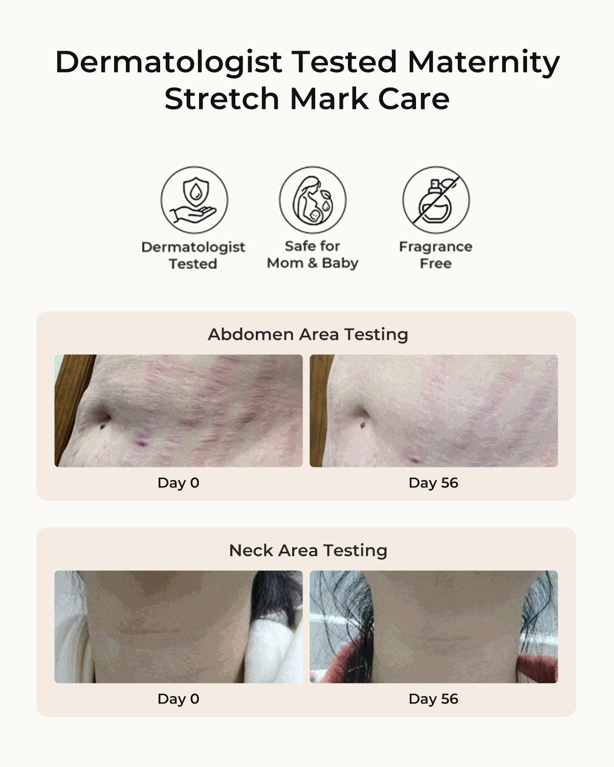 Momcozy Pro-Collagen Belly Firming Moisturizer